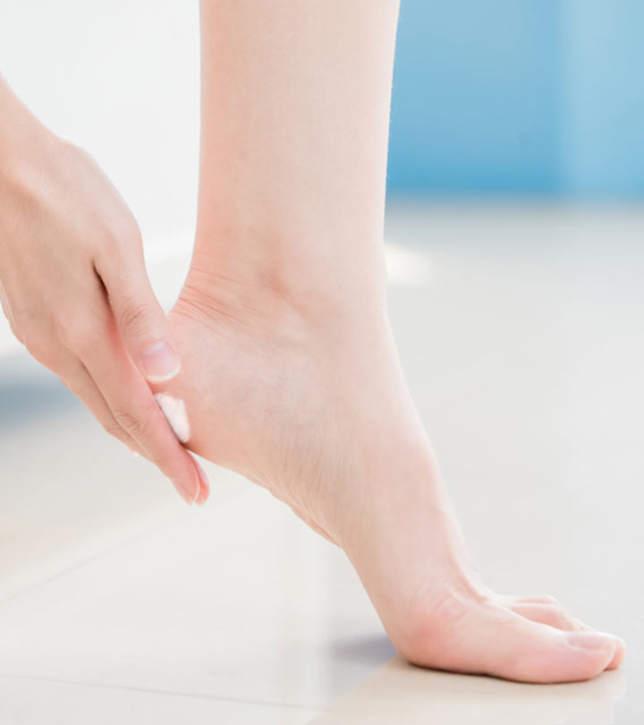 Well-Heeled: How to Treat Cracked Heels