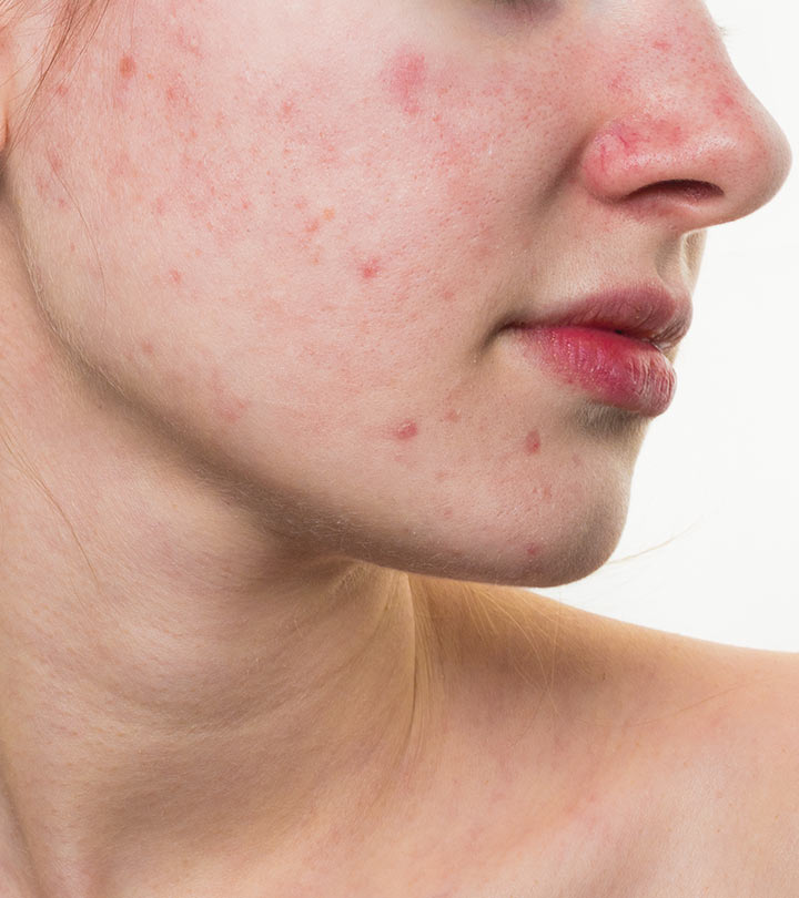 red bumps on face