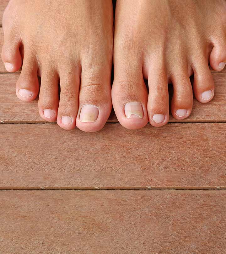 Causes of Sharp Pain in Big Toe and When to Contact a Doctor