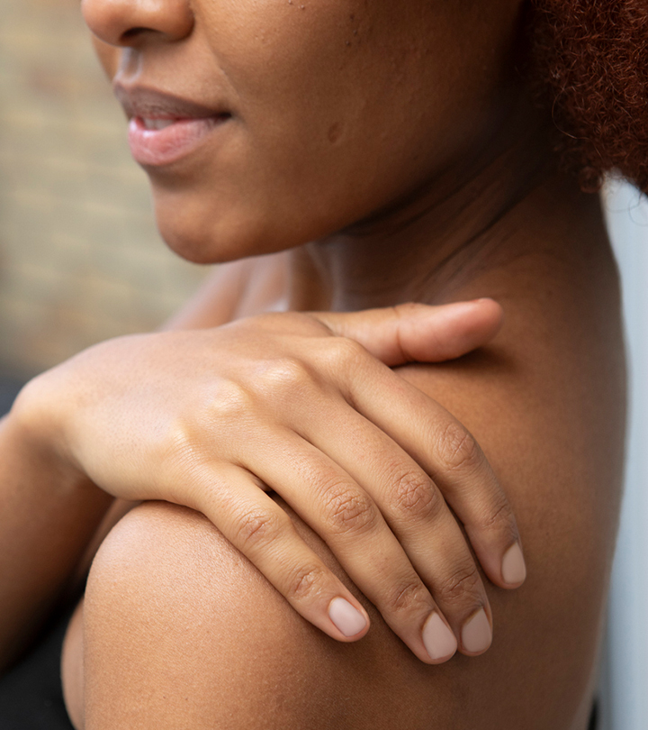 Stretch Marks On The Shoulders: Why You Get Them And How To