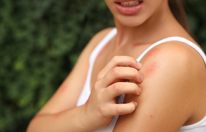 Skin Inflammation: The Ultimate Guide with Causes & Treatment