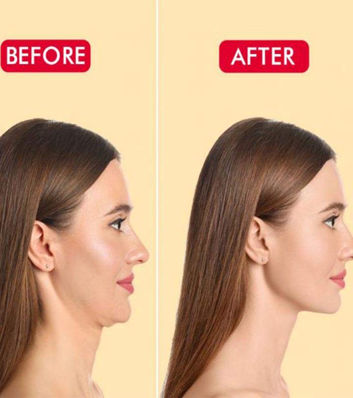 How You Can Get a Chiseled Jawline Like Celebrities Naturally
