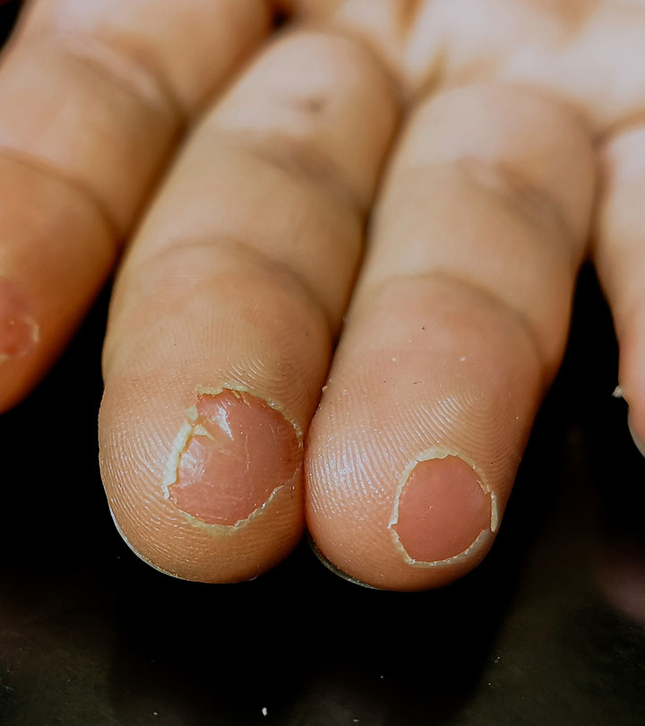 Skin 'fraying' at the base of the nail? - NailKnowledge