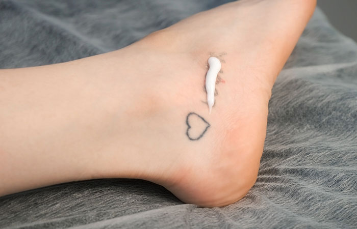 Shop Permanent Tattoo Removal Laser online | Lazada.com.ph
