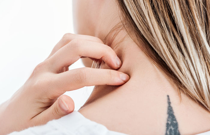Allergy to henna tattoo - DocCheck