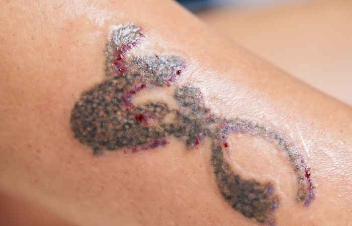 Yellow Tattoo Ink Healing Process | TikTok