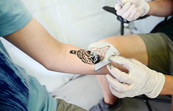 The Pros and Cons of Tattoo Removal - Arts of Attraction