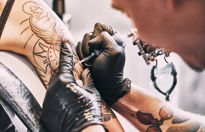 Tattoo Excision | Ask A Surgeon