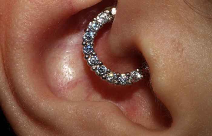 Can daith piercings help with migraines?