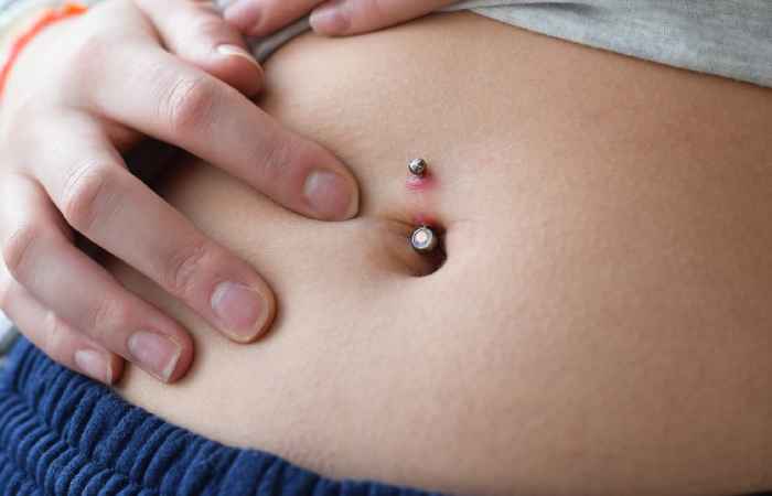 Keloid Belly Button Piercing: Definition, Treatment, Prevention