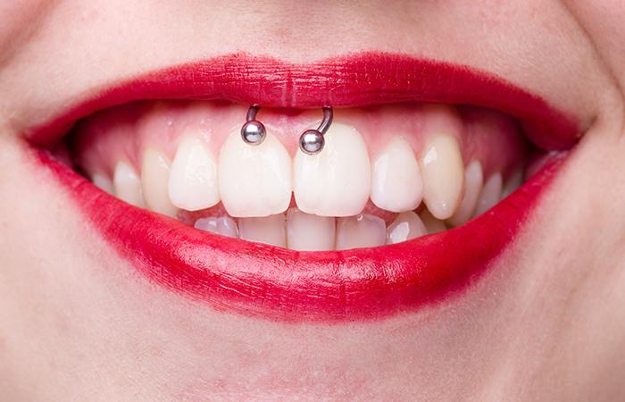 Smiley piercing clearance with curved barbell